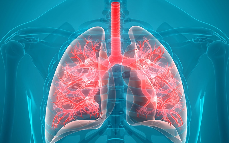 xray image of lungs