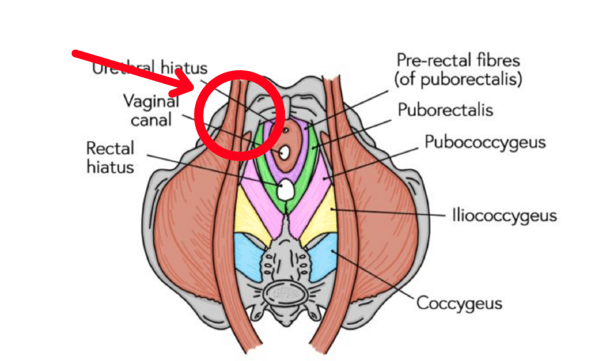 Prolapse Queen