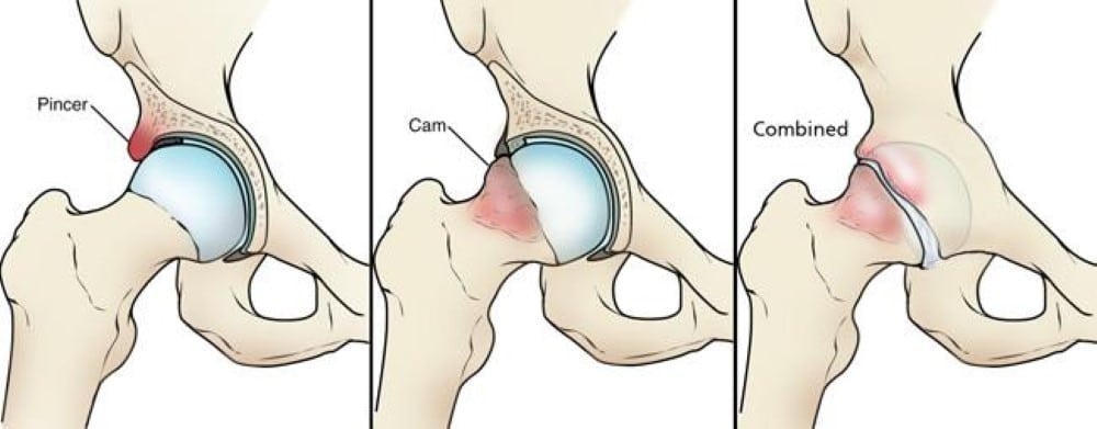 FAI Physio Eastern Suburbs